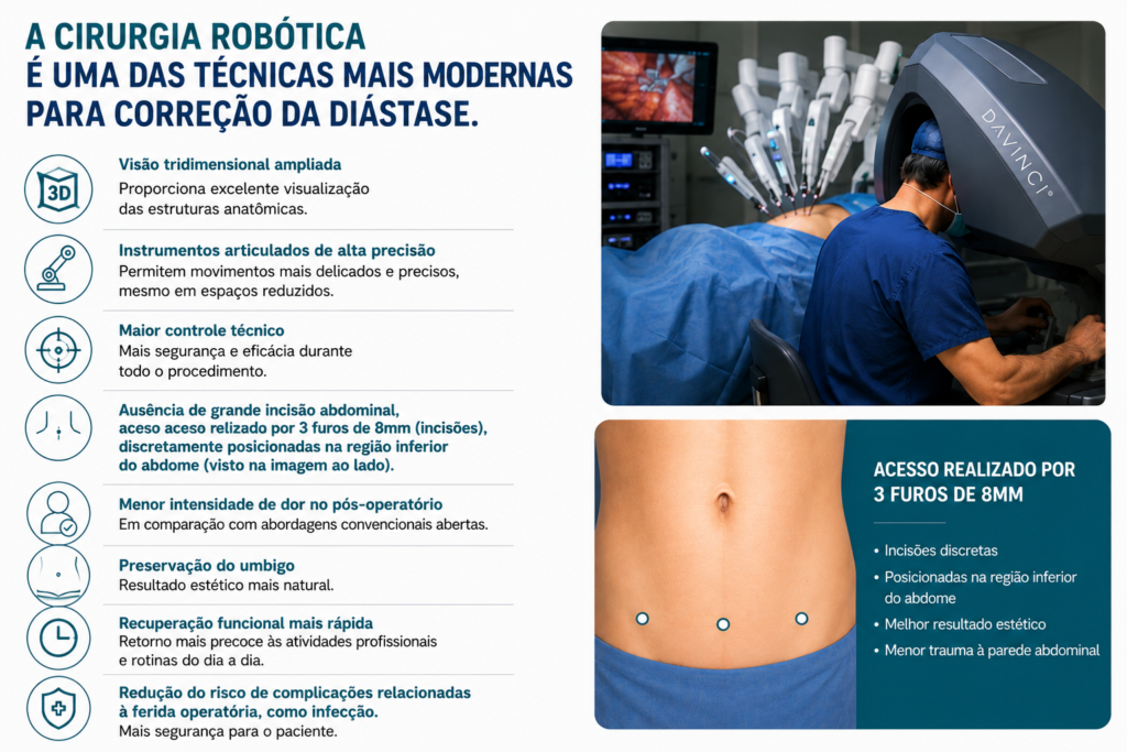 Correção de diástase por cirurgia robótica.