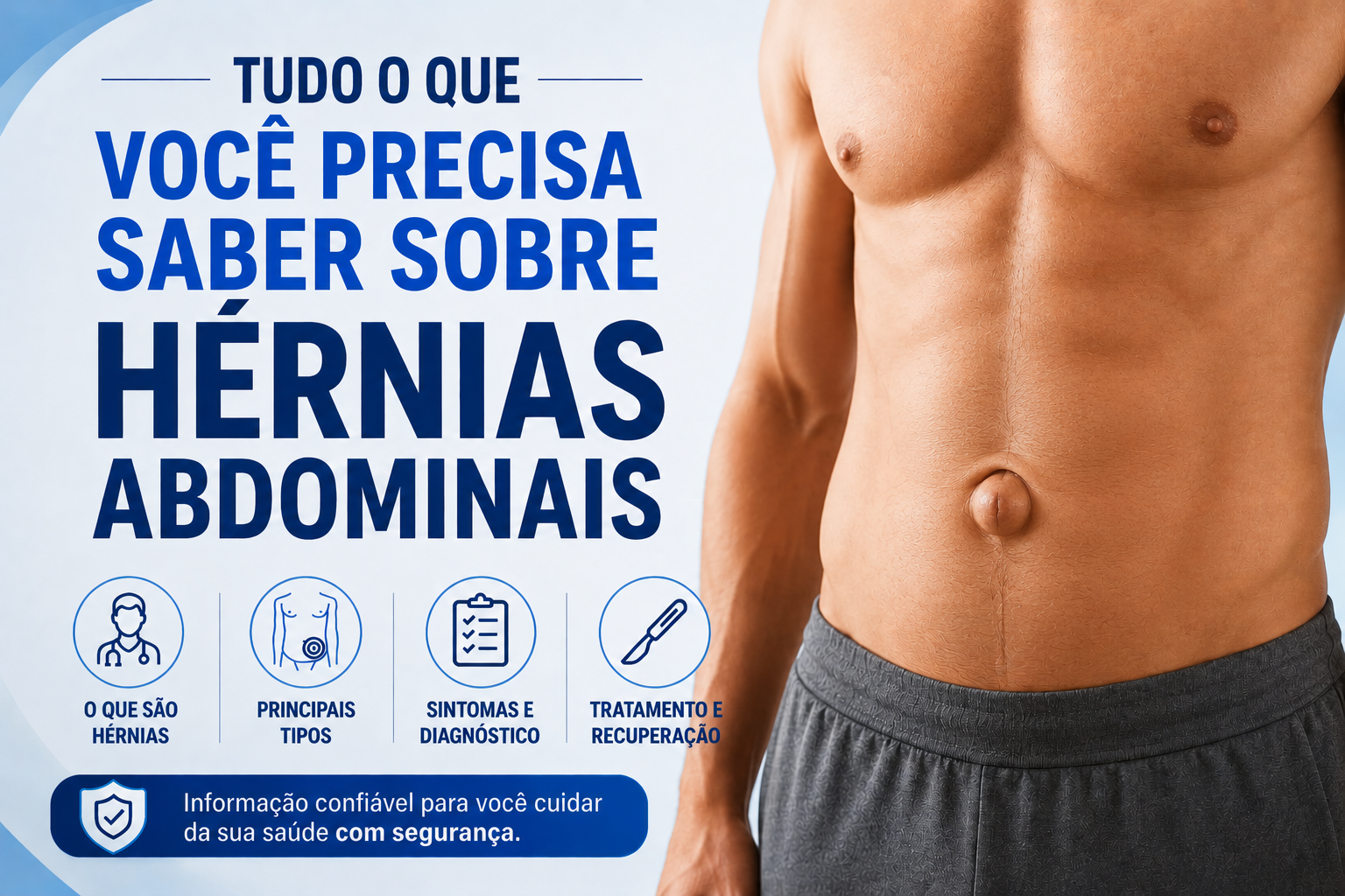 O que você precisa saber sobre hérnias abdominais. Em evidência, hérnia umbilical.
