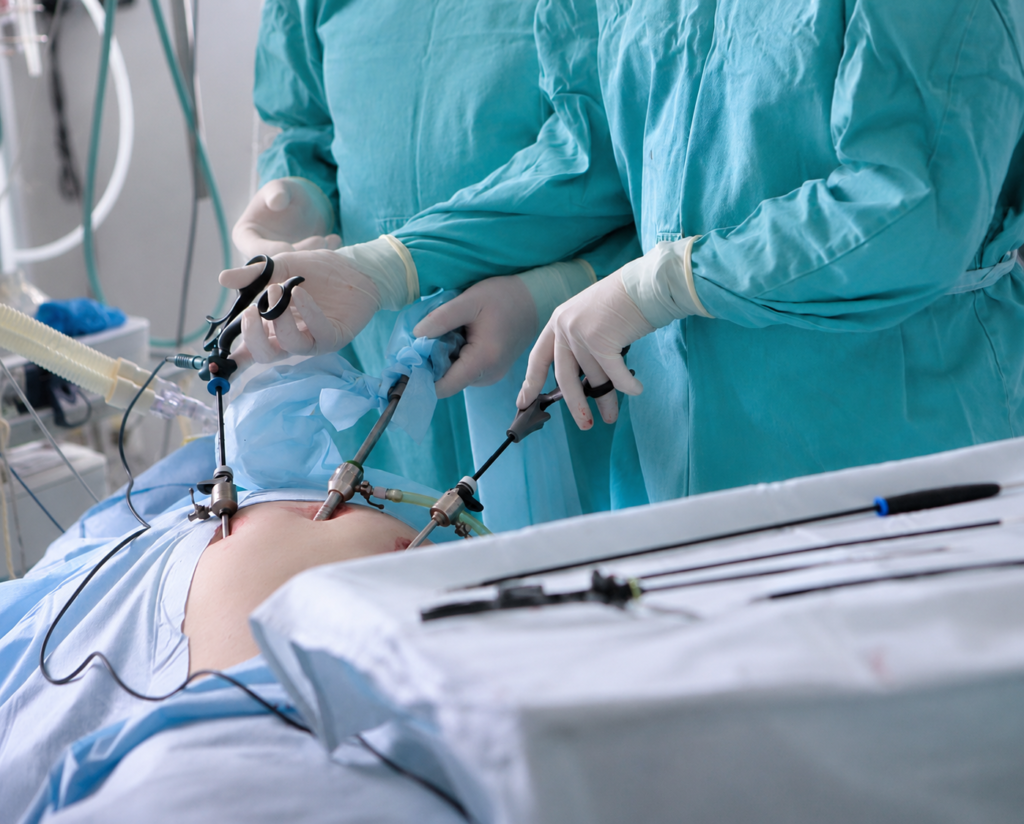 Cirurgia de hérnia inguinal por videolaparoscopia.