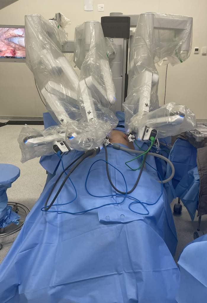 hernia inguinal robotica